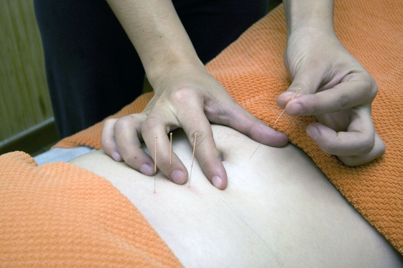 osteopathe-ROQUEFORT LES PINS-min_acupuncture-4175625